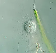 Actinophrys sol thumbnail 4