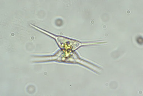 Staurodesmus triangularis