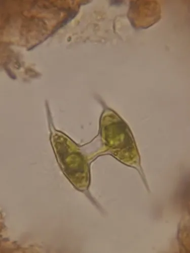 Staurodesmus cuspidatus