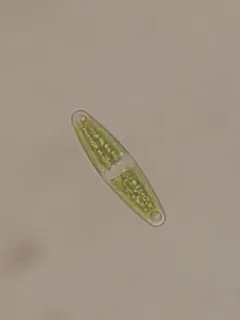Closterium navicula thumbnail 3