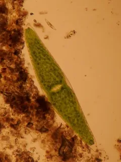 Closterium lunula thumbnail 2