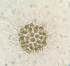 Chrysosphaerella longispina thumbnail 2