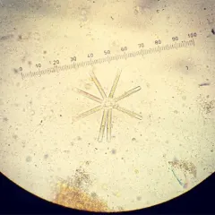 Thalassionema nitzschioides thumbnail 1