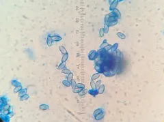 Ramaria tsugina thumbnail 4