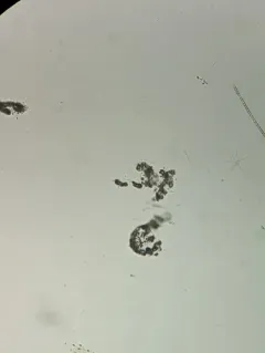 Microcystis wesenbergii thumbnail 3