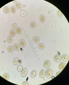 Sphaerosporium lignatile thumbnail 2