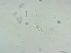 Mallomonas insignis thumbnail 4