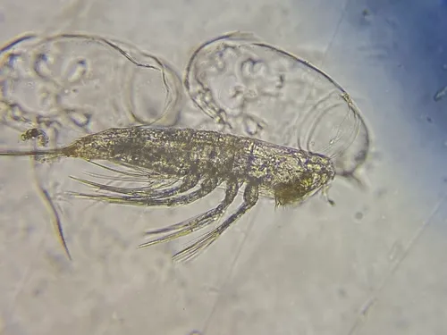 Microsetella norvegica