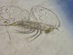 Microsetella norvegica thumbnail 1