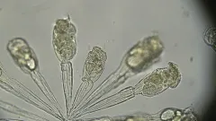 Conochilus hippocrepis thumbnail 3