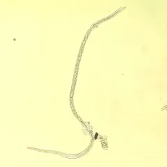 Beech Leaf Disease thumbnail 2