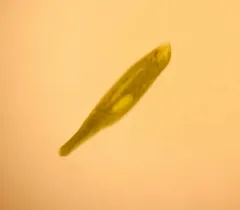 Euglena ehrenbergii thumbnail 4