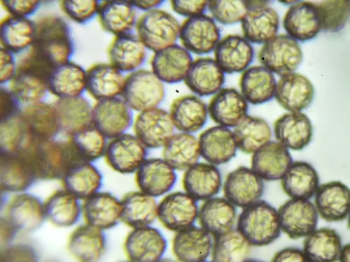 Stemonitopsis hyperopta