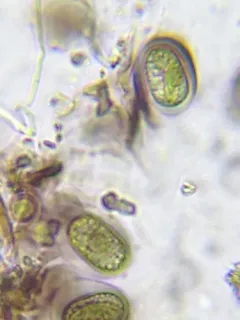 Mesotaenium macrococcum thumbnail 2