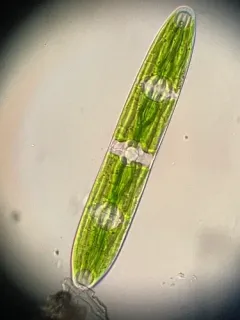 Planotaenium interruptum thumbnail 3