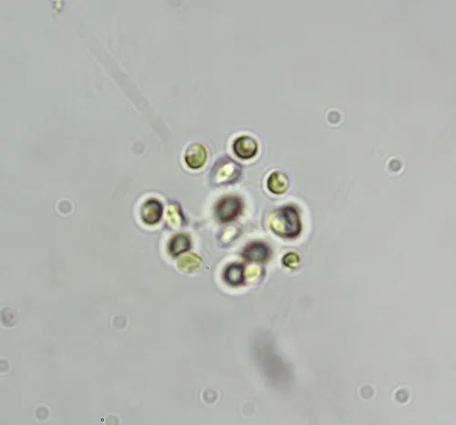 Dictyosphaerium ehrenbergianum