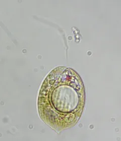 Phacus acuminatus thumbnail 3