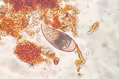 Cyphoderia ampulla thumbnail 2