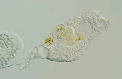 Cephalodella forficula thumbnail 3
