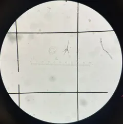 Ceratium hirundinella thumbnail 4