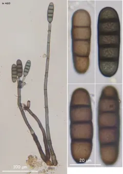 Kirschsteiniothelia atra thumbnail 1