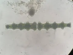 Pleurotaenium nodosum thumbnail 4