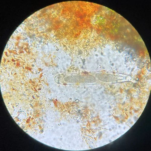 Pertusaria neoscotica