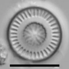 Discostella stelligera thumbnail 2
