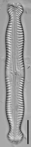 Pinnularia nodosa