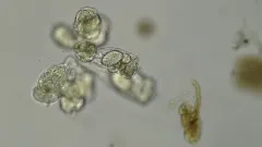 Sheathed Rotifer thumbnail 1