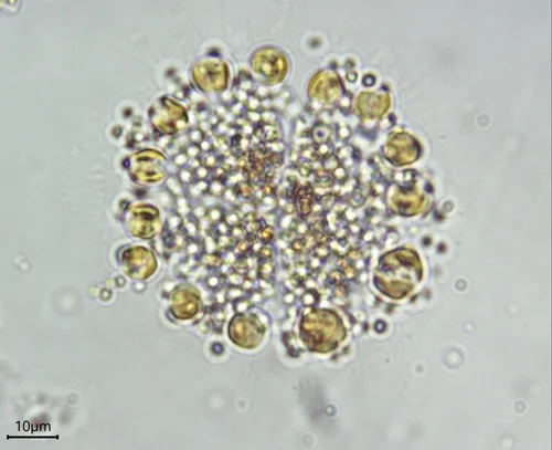Chrysostephanosphaera globulifera