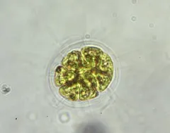 Pandorina morum thumbnail 2