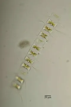 Chaetoceros didymus thumbnail 3