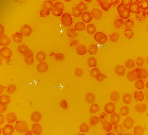 Haemophilus influenzae