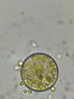 Stephanodiscus niagarae thumbnail 4