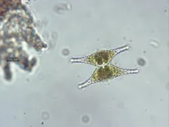 Staurastrum anatinum thumbnail 4