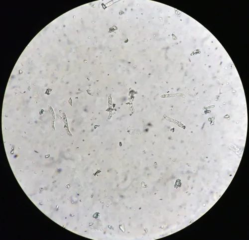 Lasiosphaeris hirsuta
