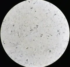 Lasiosphaeris hirsuta thumbnail 1