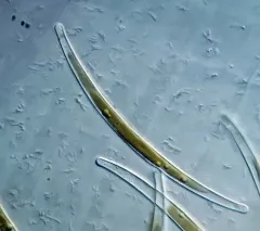 Fragilaria cyclopum thumbnail 1