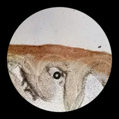 Goldleaf Shield thumbnail 3