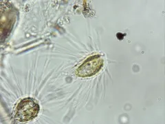 Mallomonas caudata thumbnail 2