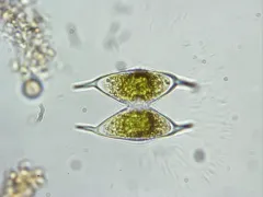 Staurodesmus megacanthus thumbnail 2