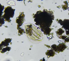 Phacodinium metchnikoffi thumbnail 2