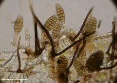 Septosporium bulbotrichum thumbnail 1