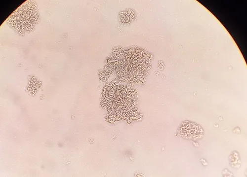 Tubercle Bacterium