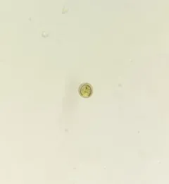 Trachelomonas volvocina thumbnail 2