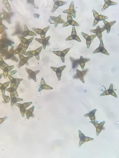 Prosthemium neobetulinum thumbnail 2