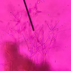 Hypomyces tubariicola thumbnail 3