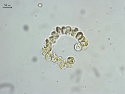 Cyclonexis annularis