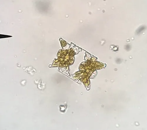 Odontella aurita